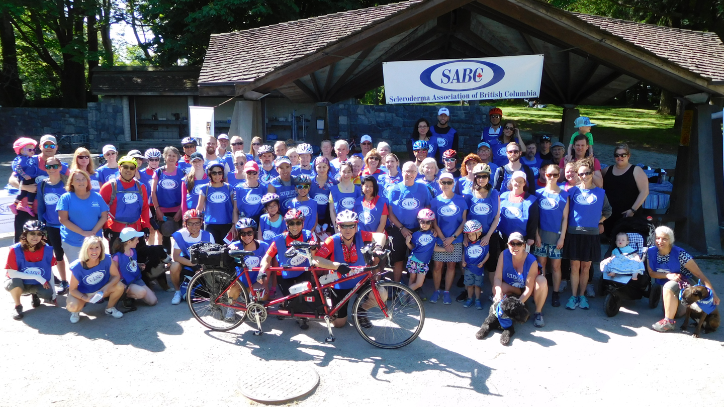 Scleroderma Association of B.C. members with their bicycles at their 2018 Ride for Research.